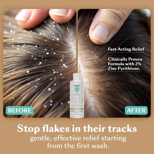 DHS Zinc Shampoo - Dandruff Relief for Flaky & Dry Scalp with 2% Zinc Pyrithione | 8 oz