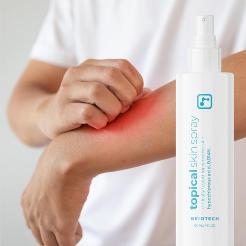 BRIOTECH Topical Skin Spray, Hypochlorous Acid Spray for Sensitive Skin, HOCl Facial Mist, Full Body Support Against Irritation, Calm Redness, Soothe Foot & Scalp, 8.5 oz (2 Pack)