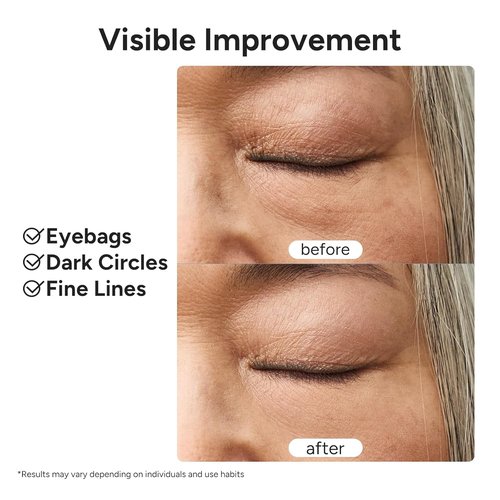 In My Eyes Eye Repair Gel Cream - Caffeine & Lutein Anti-Wrinkle Treatment for Dark Circles | 0.5 oz