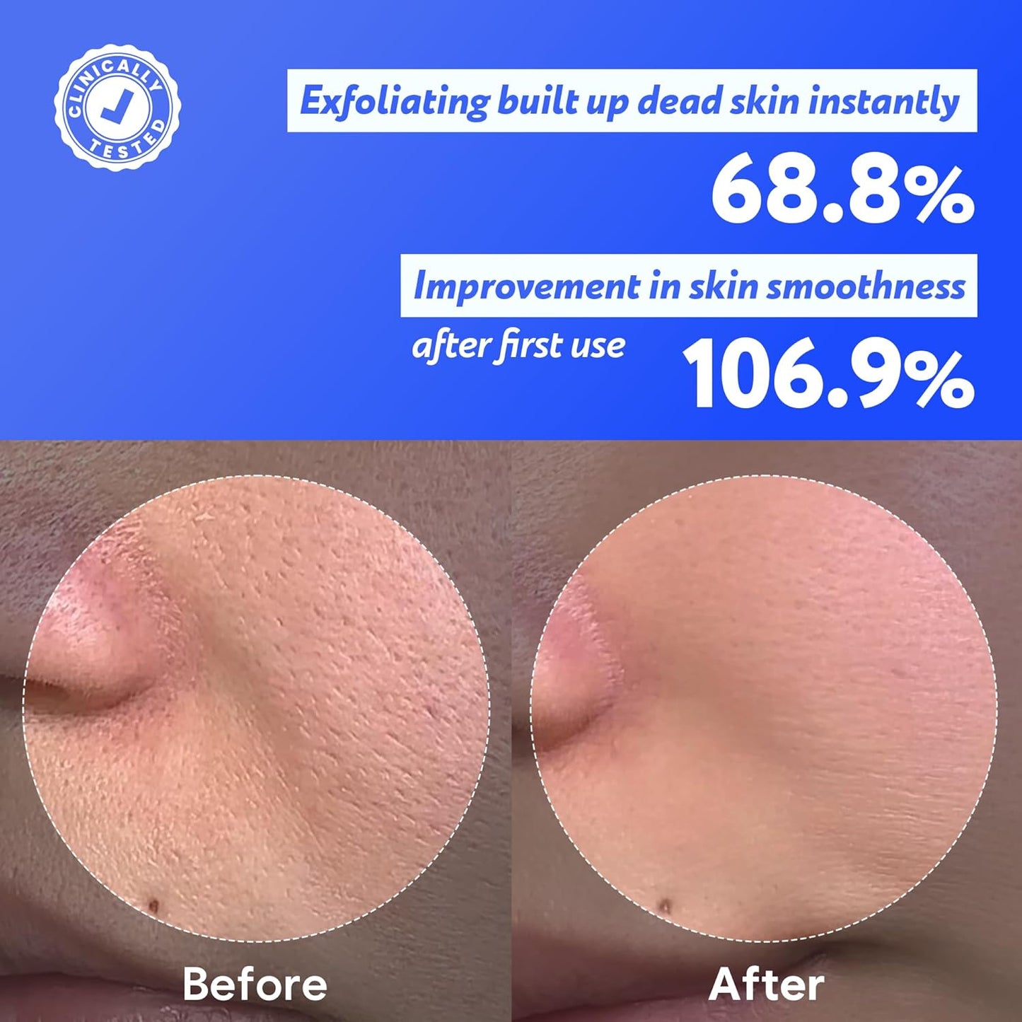 Skiennix Coconut Jelly Pudding Cleanser - Deep Pore Cleansing & Gentle Exfoliation | Hydrating Face Wash with Panthenol, Ceramide & Peptides (100ml)