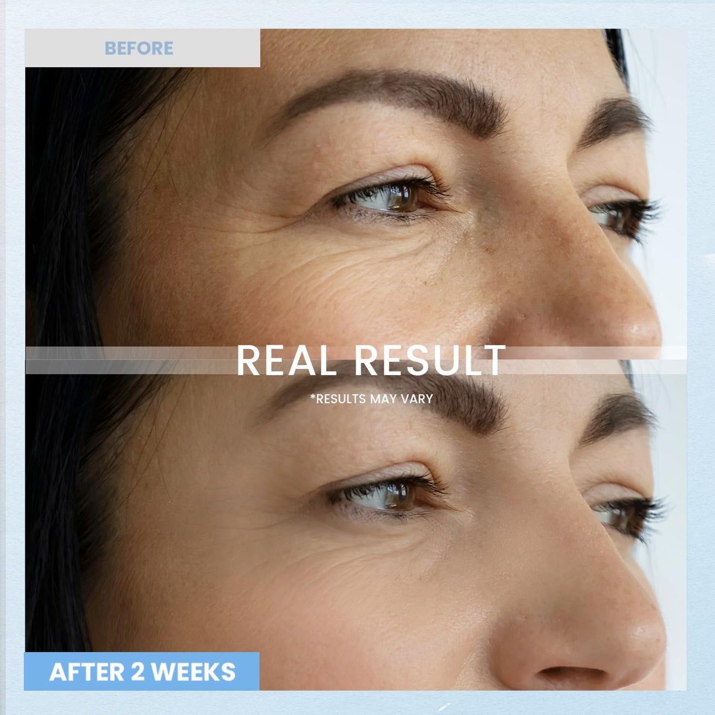 Skiennix Retinol Eye Cream - Anti-Wrinkle Formula for Dark Circles & Eye Bags | 0.5 fl. oz