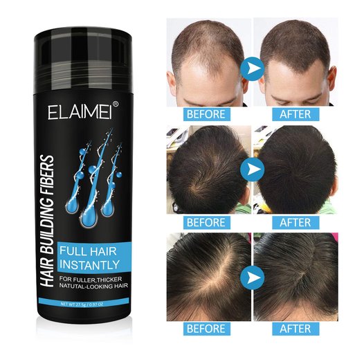 Hair Fibers for Thinning Hair, Natural Formula Hair Fiber, Hair Building Fibers Refill Thicker Hair in 15 Seconds, Conceals Hair Loss & Look Younger, Designed for Men & Women (Light Brown)
