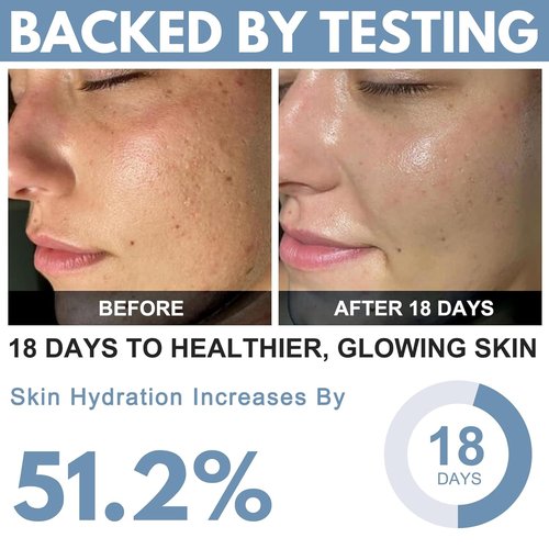 Ribose Cream - Anti-Aging Moisturizer with D-Ribose & Coconut Oil | Tightens & Firms Skin, 2.5 oz