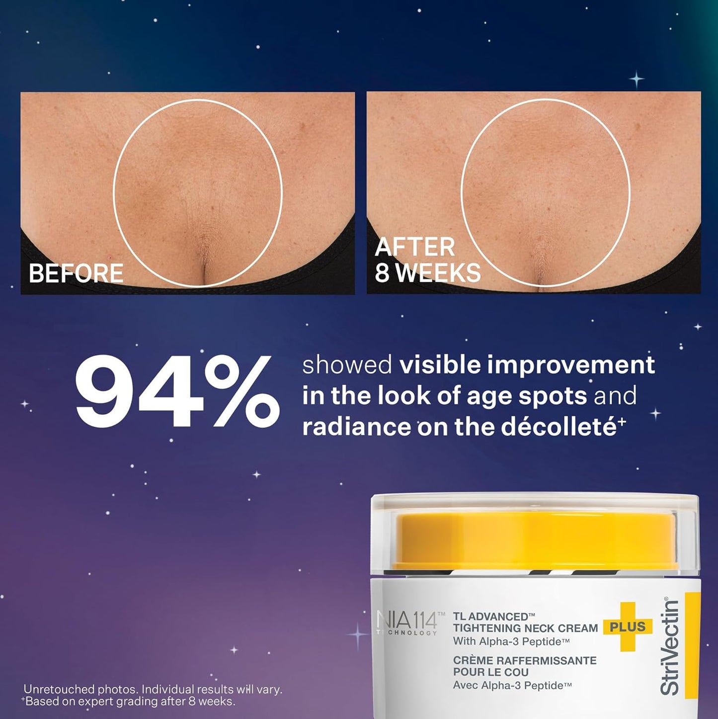 StriVectin TL Advanced Tighten & Sculpt Kit - Brighten & Lift Skin Tone with Peptides & Hyaluronic Acid