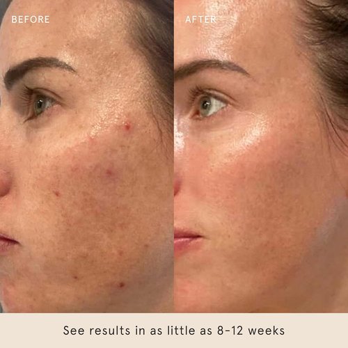 Barefaced Retinal Skin Therapy Serum 30ml - Firming Retinaldehyde & Bakuchiol for Youthful Skin
