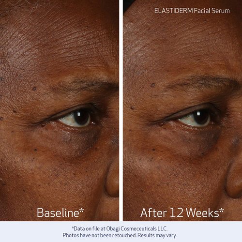 Obagi ELASTIDERM Facial Serum & Eye Serum Set - Firm Skin & De-Puff Eyes with Caffeine | 1oz & 0.47oz