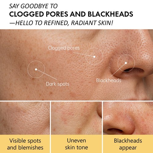 Roseblem Warming Clay Facial Mask for Deep Pore Cleansing – Self-Heating Mud Mask for Face, Purifying & Pore-Refining Treatment, Helps Remove Blackheads, Improves Skin Texture, Spa-Like Care, 4.94Oz