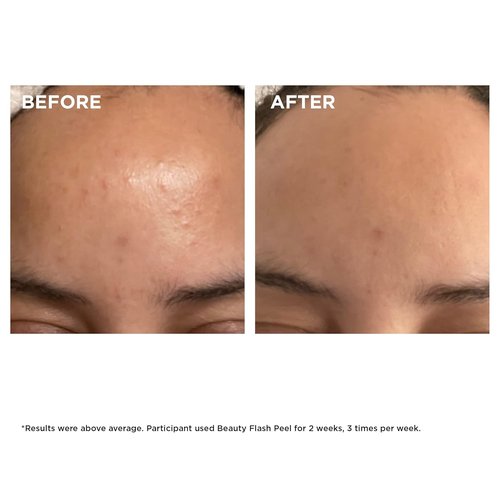 Clarins Beauty Flash Peel - 10-Minute At-Home Facial for Radiant Skin | Refines Texture & Tightens Pores