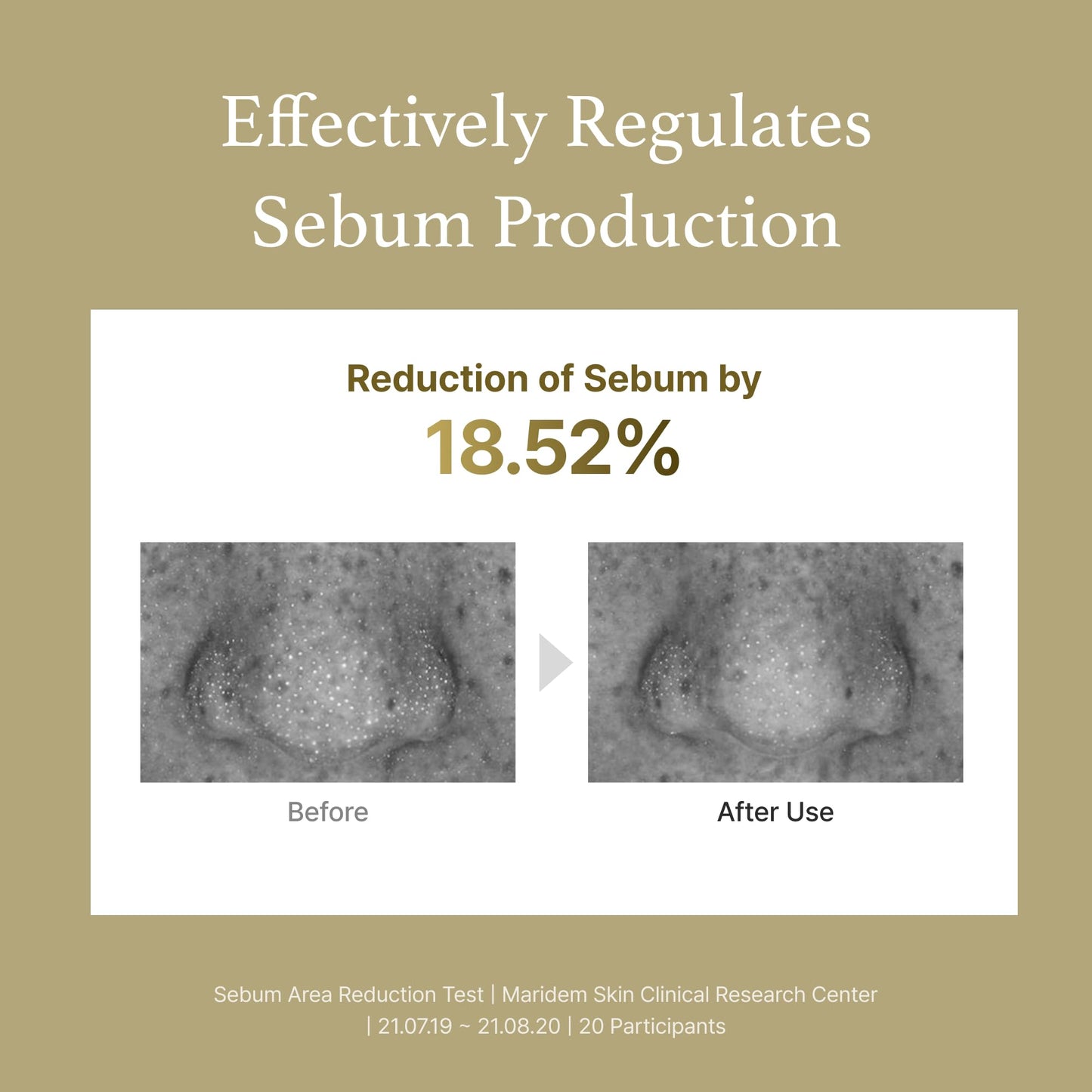 I'm From Mugwort Essence | Vegan Extract - Soothe Sensitive and Irritated Skin, Redness Relief, Refreshing, Korean Hydrating Toner | 5.4 Fl Oz, All Skin Types, PETA Approved