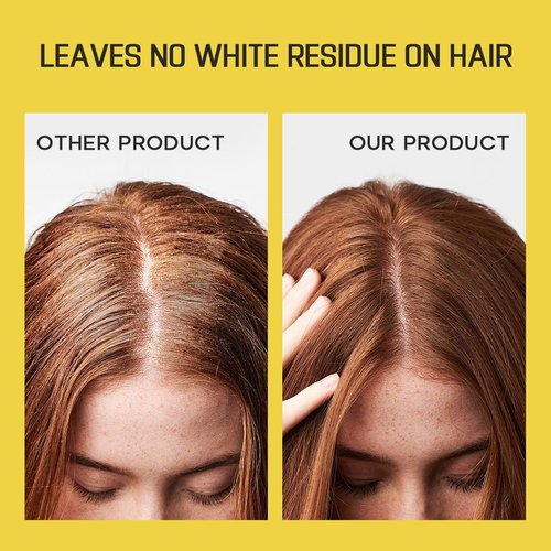 HALOVIDA Dry Shampoo Spray for Dark Hair - Oil Absorbing, Volumizing & Residue-Free, 5.07 Fl Oz (Pack of 2)