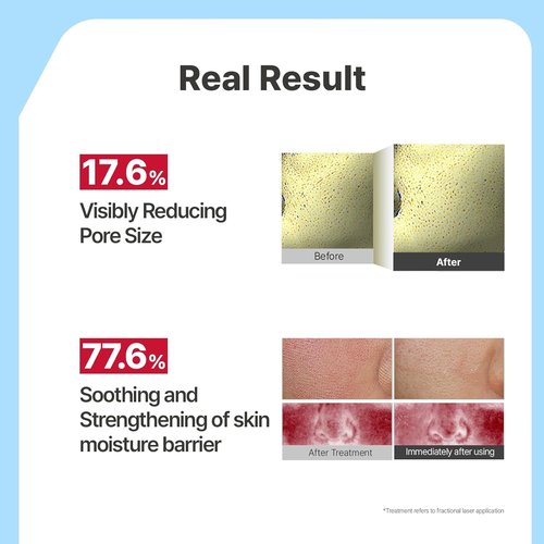 Illiyoon Ceramide Ato Concentrate Gel Face Mask - Hydrating Overnight Hydrogel Mask with Hyaluronic Acid | 34g x 4ea, Pore Tightening, Glass Skin Glow