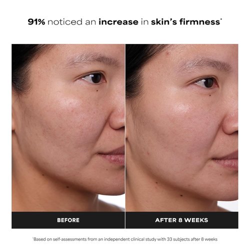 Paula's Choice Clinical 1% Retinol Face Treatment - Anti-Aging Serum with Peptides & Vitamin C | Fragrance-Free