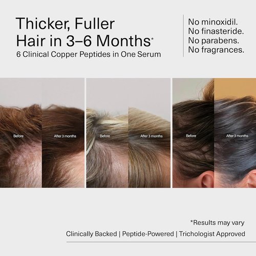 Bloom Copper GHK-CU Peptide Hair Serum - Clinically Proven for Thinning Hair | Non-Greasy & Lightweight - 3-Pack