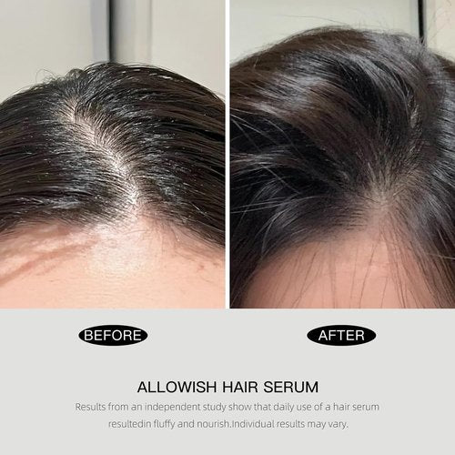 Advanced Hair Serum - 95 ml Scalp Treatment for Fuller, Nourished Hair | Prevents Frizz & Strengthens Roots