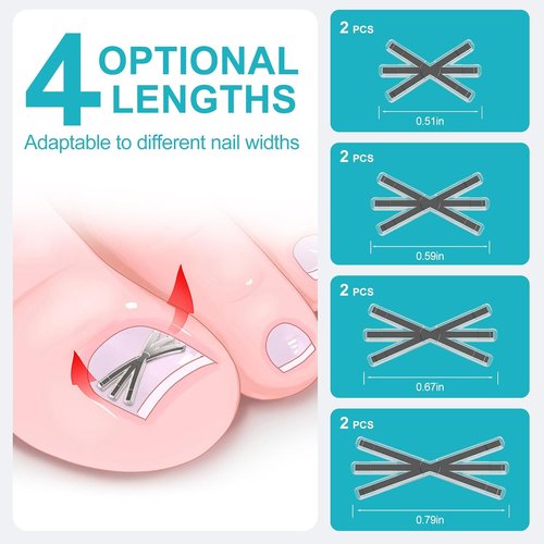 **Ingrown Toenail Treatment Kit - Titanium Alloy Corrector Tools with 4 Sizes & Quick Relief Strips | 8 Pieces**