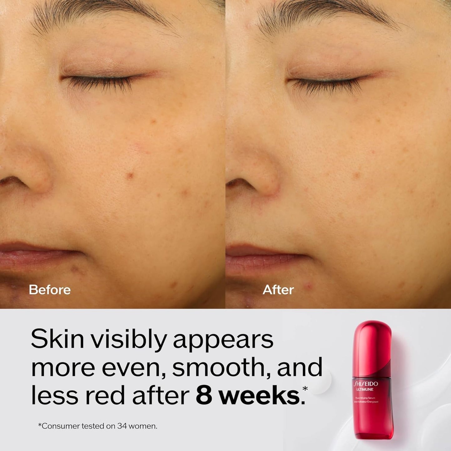 Shiseido Ultimune Power Infusing Serum - Lightweight Anti-Aging Face Serum - Boosts Radiance for All Skin Types