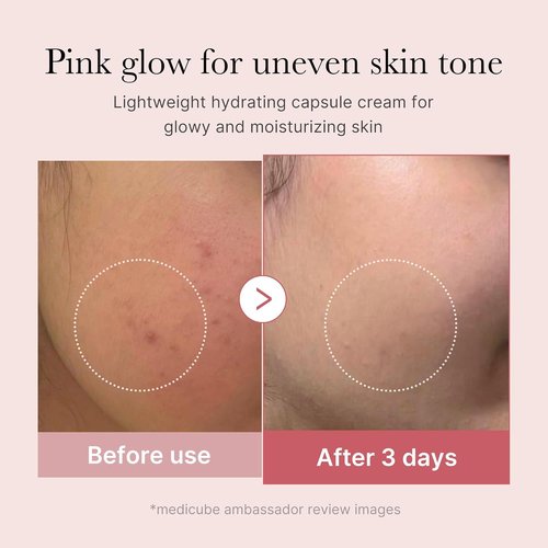 Medicube Capsule Cream - Salmon DNA PDRN & Niacinamide | Lightweight Moisturizer for Even Skin Tone | 1.94 oz