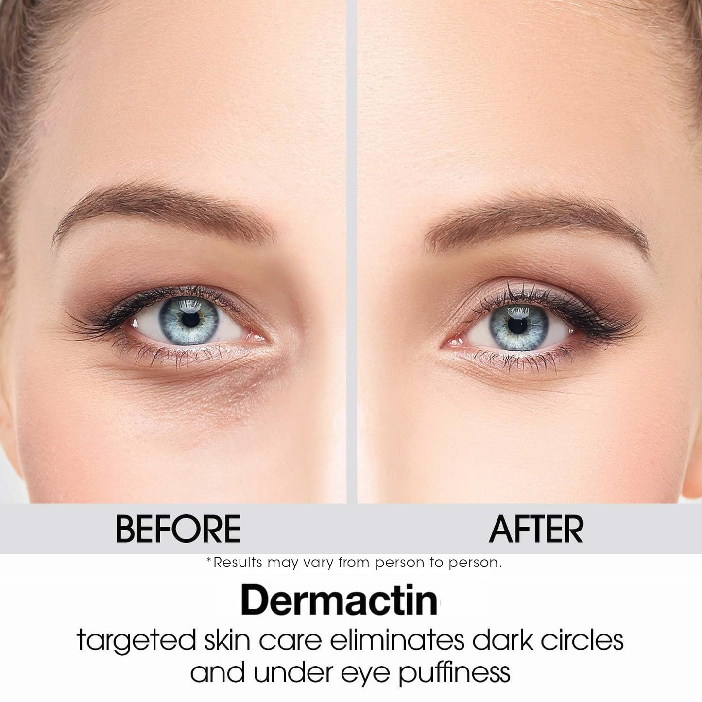 Dermactin Upper Eyelid Cream - Firm & Tone Sagging Skin for Youthful Appearance | 1 oz, Sensitive Skin