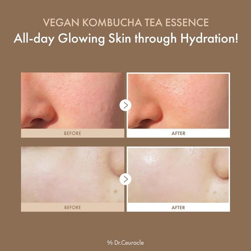 Dr.Ceuracle Vegan Kombucha Tea Essence - Hydrating Milky Toner with Centella & Ceramide | 150 ml