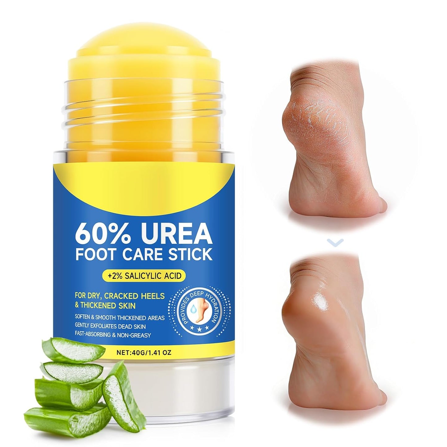Skiennix 60% Urea Cream Stick - Maximum Strength Foot Cream with 2% Salicylic Acid | Softens Dry Cracked Heels