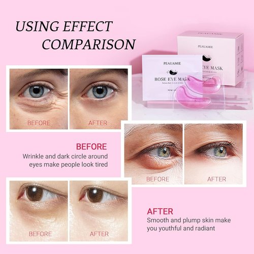 PEAUAMIE Under Eye Patches - Rose Eye Mask for Dark Circles & Puffiness | 30 Pairs