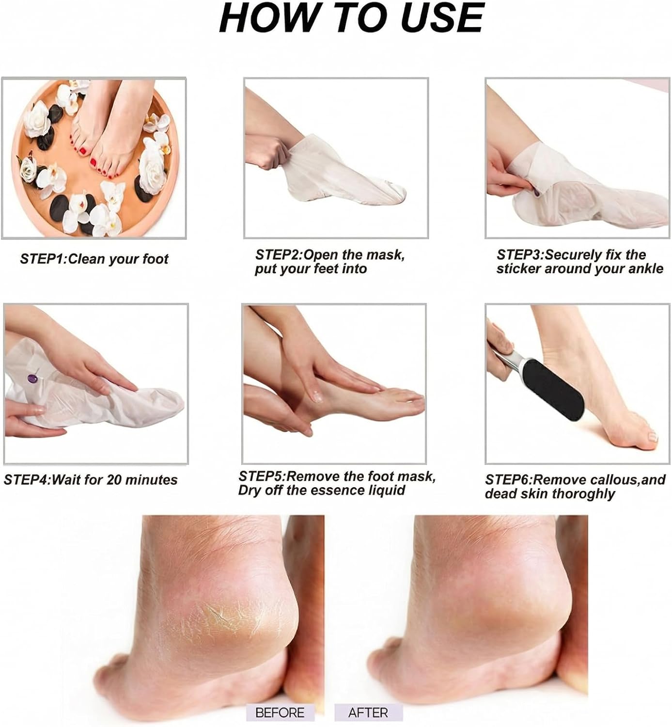 Skiennix Stainless Foot File Callus Remover - 3-in-1 Pedicure Kit with 10 Replacement Pads & 2 Exfoliating Masks