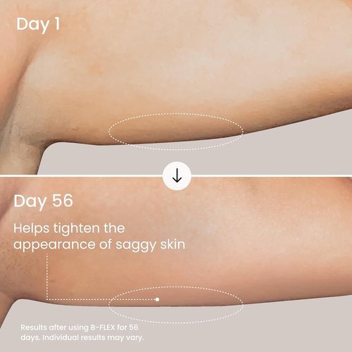 MAËLYS B-FLEX Firming Arm Cream - Tightening Cream for Crepey Skin with Red Algae & Kangaroo Flower | 3.4 Fl Oz