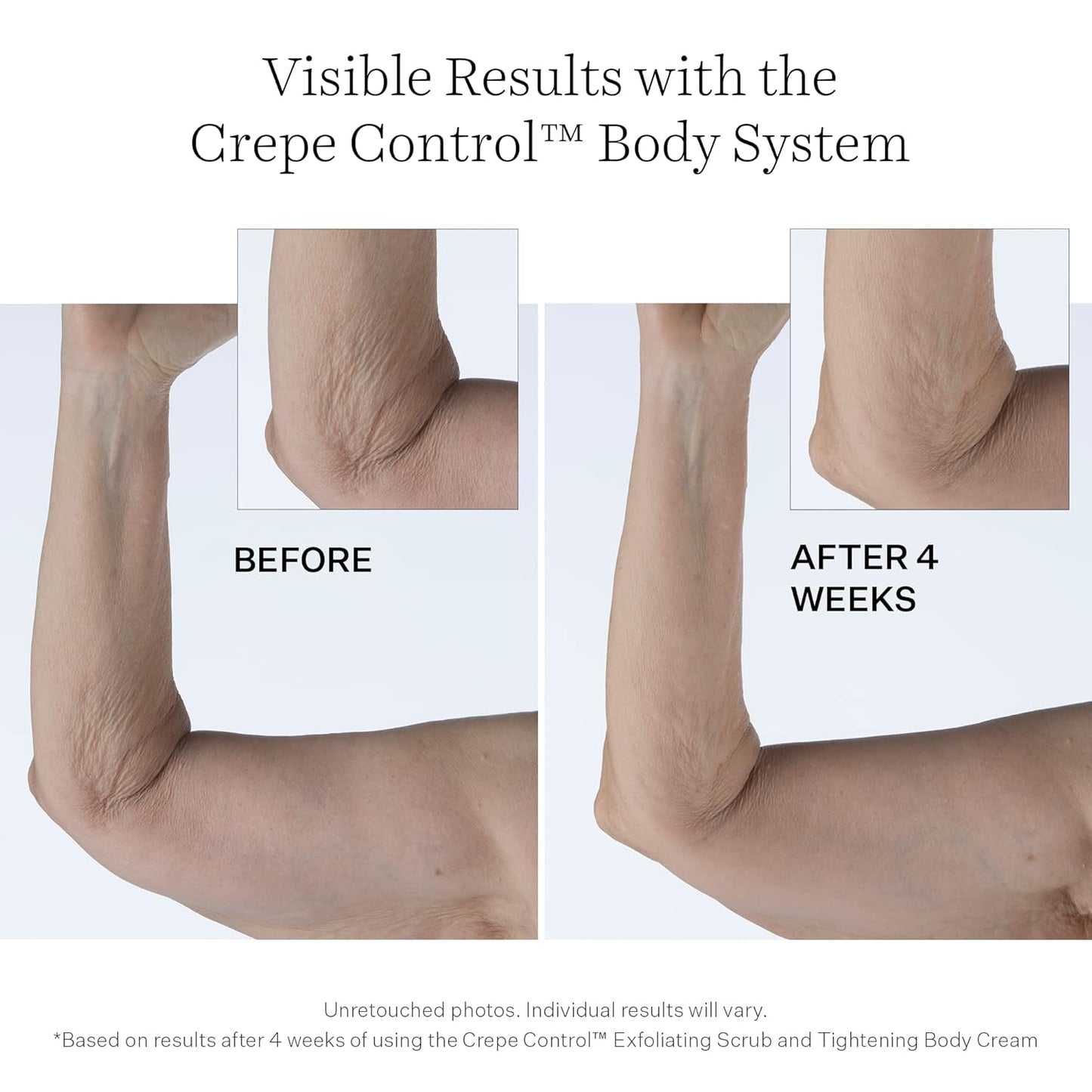 StriVectin Crepe Control Body Cream - Tightening Formula | Jumbo Size for Enhanced Firmness