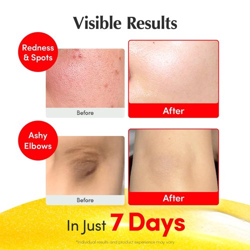 EQQUALBERRY Vitamin Illuminating Serum - Brightening 4% Niacinamide & Vitamin C | Dark Spot Care | 1.01 fl. oz