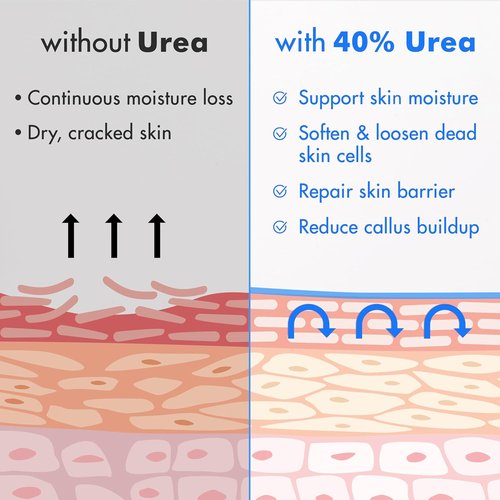 Ebanel Urea Cream 40% | Salicylic Acid Foot Cream for Dry Cracked Heels & Skin Repair