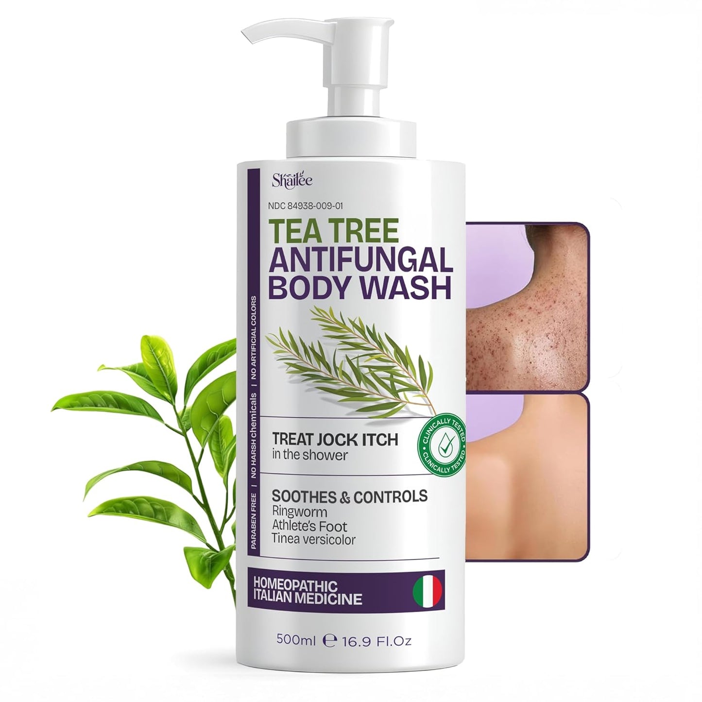 Antifungal Tea Tree Body Wash - Effective Eczema, Jock Itch & Back Acne Treatment | 1% Tolnaftate & Tea Tree Oil - 16.9 oz