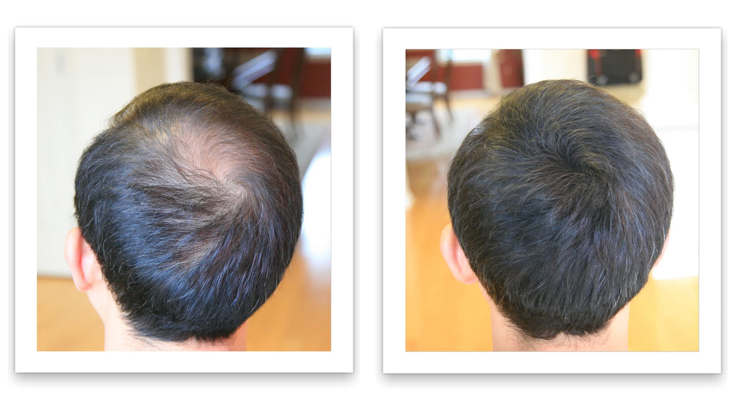 Caboki 10X Hair Powder for Thinning Hair Auburn, TALC-Free, Healthful Formula, Instant Fuller Hair, Flawless Roots, Rain and Sweat Resistant, Easy to Use, Men Women