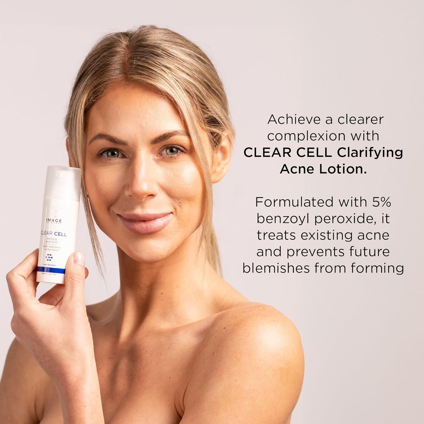 IMAGE Skincare Clear Cell Acne Treatment Lotion - Benzoyl Peroxide Formula, 1.7 oz for Blemish Control