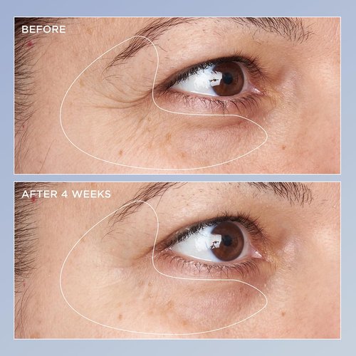 Perricone MD High Potency Eye Serum - Triple Retinol Renewal Formula | 0.5 Fl. Oz.