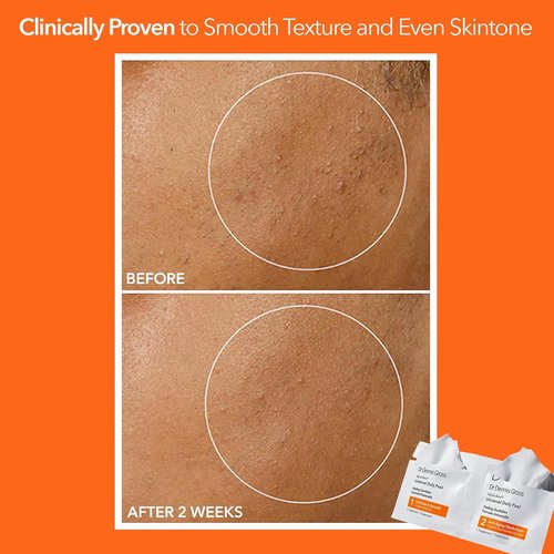Dr. Dennis Gross Alpha Beta Daily Peel - Smooth Uneven Tone & Texture | 5 Treatments for Fine Lines