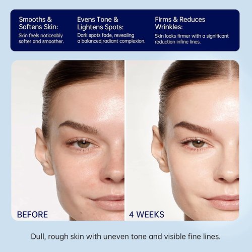 Regine Switzerland Retinol Firming Face & Neck Cream - Anti-Aging Moisturizer with Collagen & Hyaluronic Acid, 1.7 Fl Oz