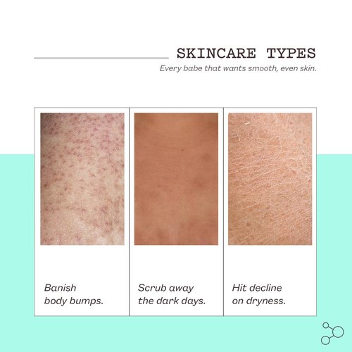 Frank Body Glycolic Acid Body Scrub - Reduces Acne & Tightens Pores | 8.82 oz | Soothing Witch Hazel