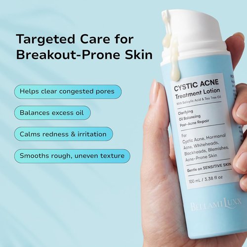 Cystic Acne Treatment for Face: Hormonal Acne Treatment Cream for Teens & Adults - Salicylic Acid & Tea Tree Oil Pimple Spot Remover - Anti-Acne Moisturizer Reduces Redness, Blemishes