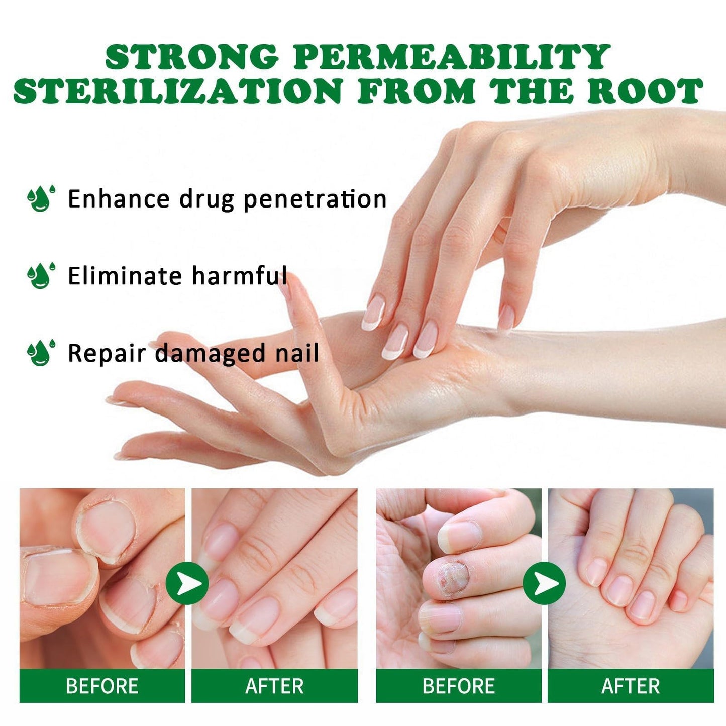 7 Days Ginger Foot Spray, 7 Days Nail Repair, 7 Days Ginger Nail Treatment, Ginger Nail Treatment (1pcs)