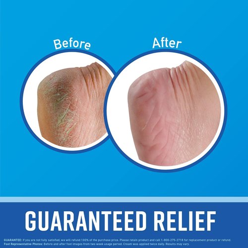 O'Keeffe's Foot Cream - Guaranteed Relief for Extremely Dry, Cracked Feet | 3.2 Ounce Jar (Pack of 3)