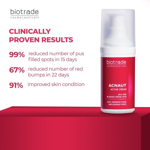 Acne Out Cream 30ml - Effective Anti-Acne Treatment for Pimples, Blackheads & Whiteheads