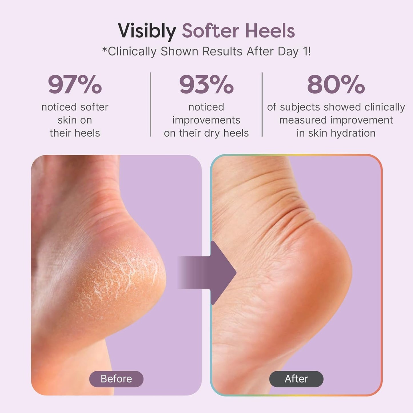 ZenToes Natural Foot Balm - Hydrating Cream for Dry, Cracked Heels & Feet | Soothes & Softens Skin | 2oz