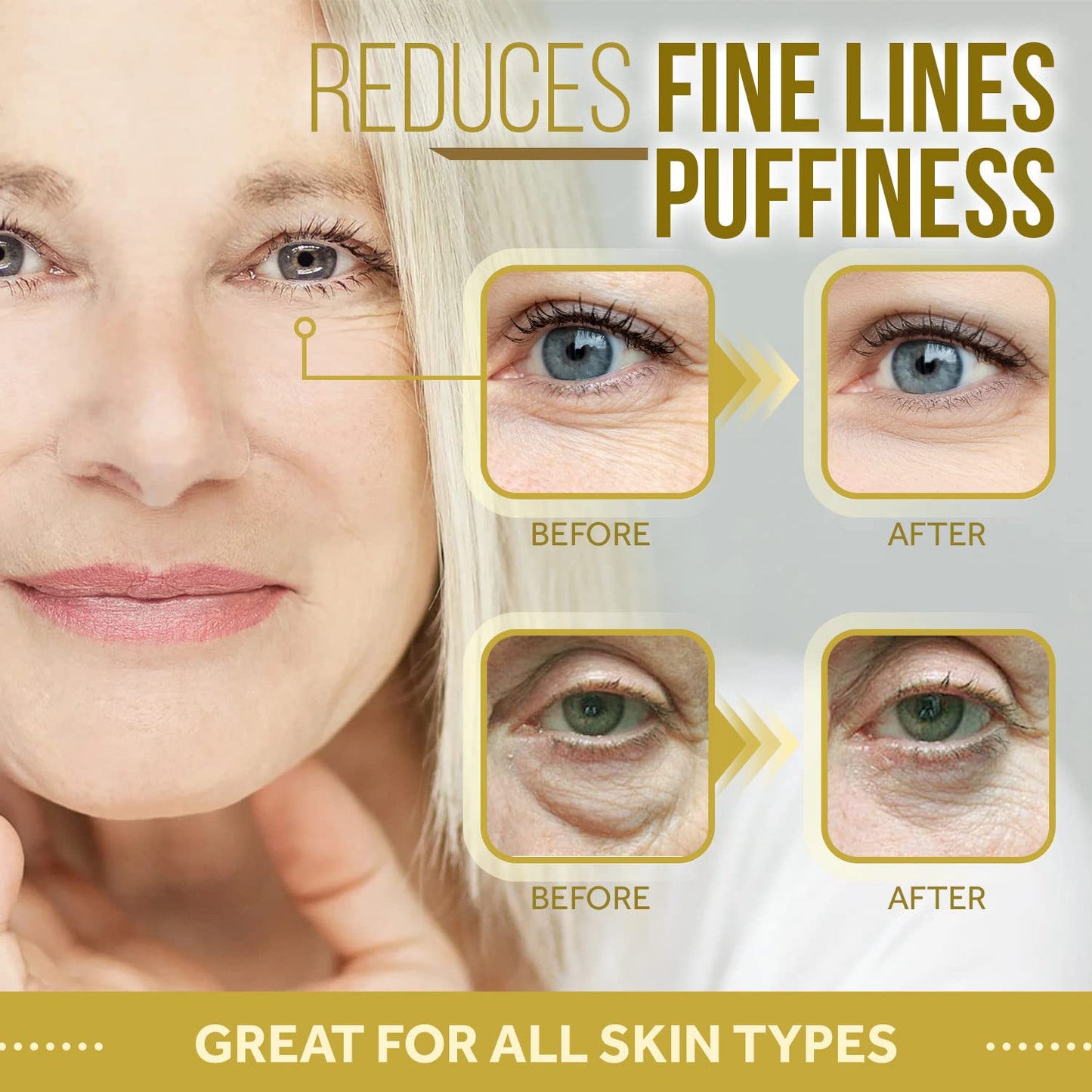 Forehead and Under Eye Wrinkle Patches for Face - Collagen, Hyaluronic Acid and Vitamin A Skin Pads - Forehead Line Remover Wrinkle Eye Patch Set - 26 Strawberry Sachets