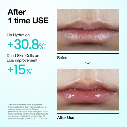 Anua PDRN Lip Serum - Long-Lasting Hydration for Dry Lips | Non-Sticky Moisturizing Care, 0.33 fl. oz