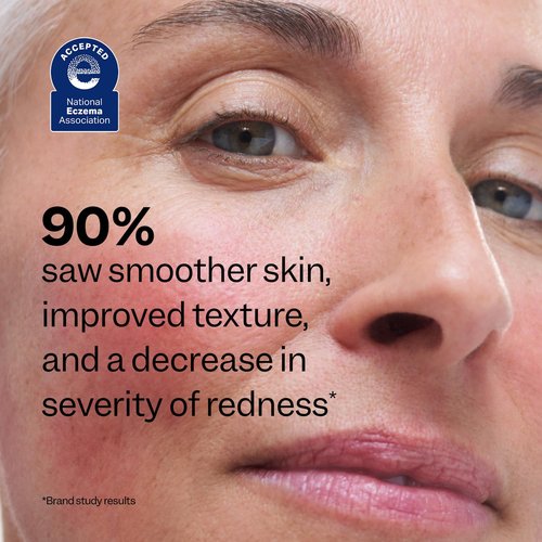 Peach Slices - Redness Relief Serum with 10% Azelaic Acid | Advanced Vegan Skincare (1.01 oz)