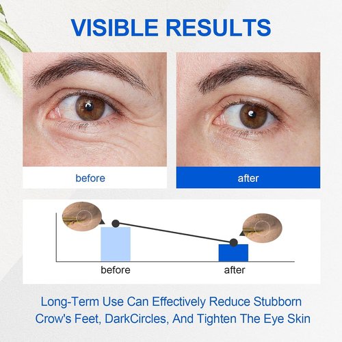 Regine Switzerland Retinol Eye Cream - Hydrating & Firming Formula for Men | Reduces Dark Circles & Puffiness, 20g
