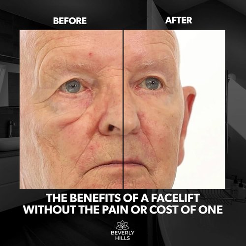 Beverly Hills Men's Instant Facelift Serum - Reduces Dark Circles & Puffy Eyes | Anti-Wrinkle Treatment