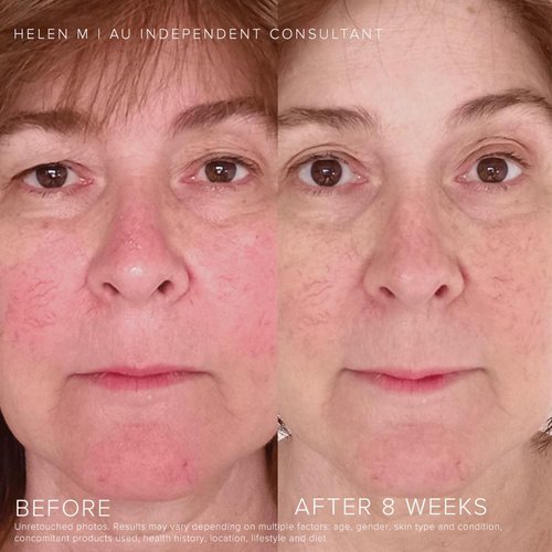 Rodan + Fields Soothe Daily Mineral Sunscreen SPF 30 - Zinc Oxide Face Moisturizer | 1 Fl Oz Travel Size