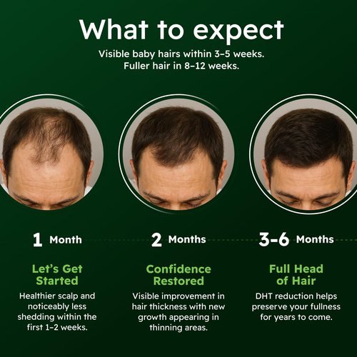 Scalp Nourishing Serum for Men by [Brand Name] - Ginseng & Eclipta Blend for Thicker Hair - 60ml