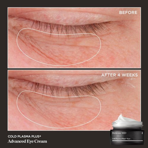 Perricone MD Cold Plasma Plus+ Eye Cream - Anti-Aging Treatment for Dark Circles & Puffiness - 0.5 fl oz